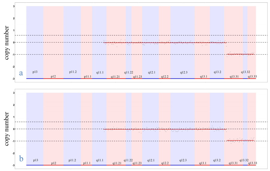 蘭州大(dà)學第一醫院發表基于GenoCare測序平台的(de)Phelan-McDermid綜合征案例研究成果